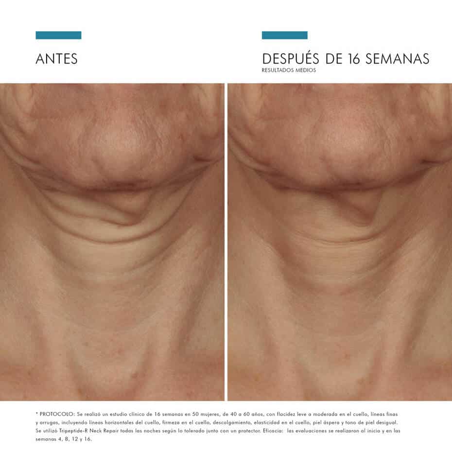 Skinceuticals, Tripeptide-R Neck Repair Ml