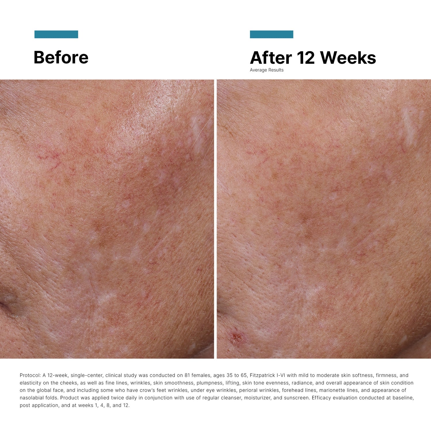 Skinceuticals, H A Intensifier Multi Glycan, 30ml