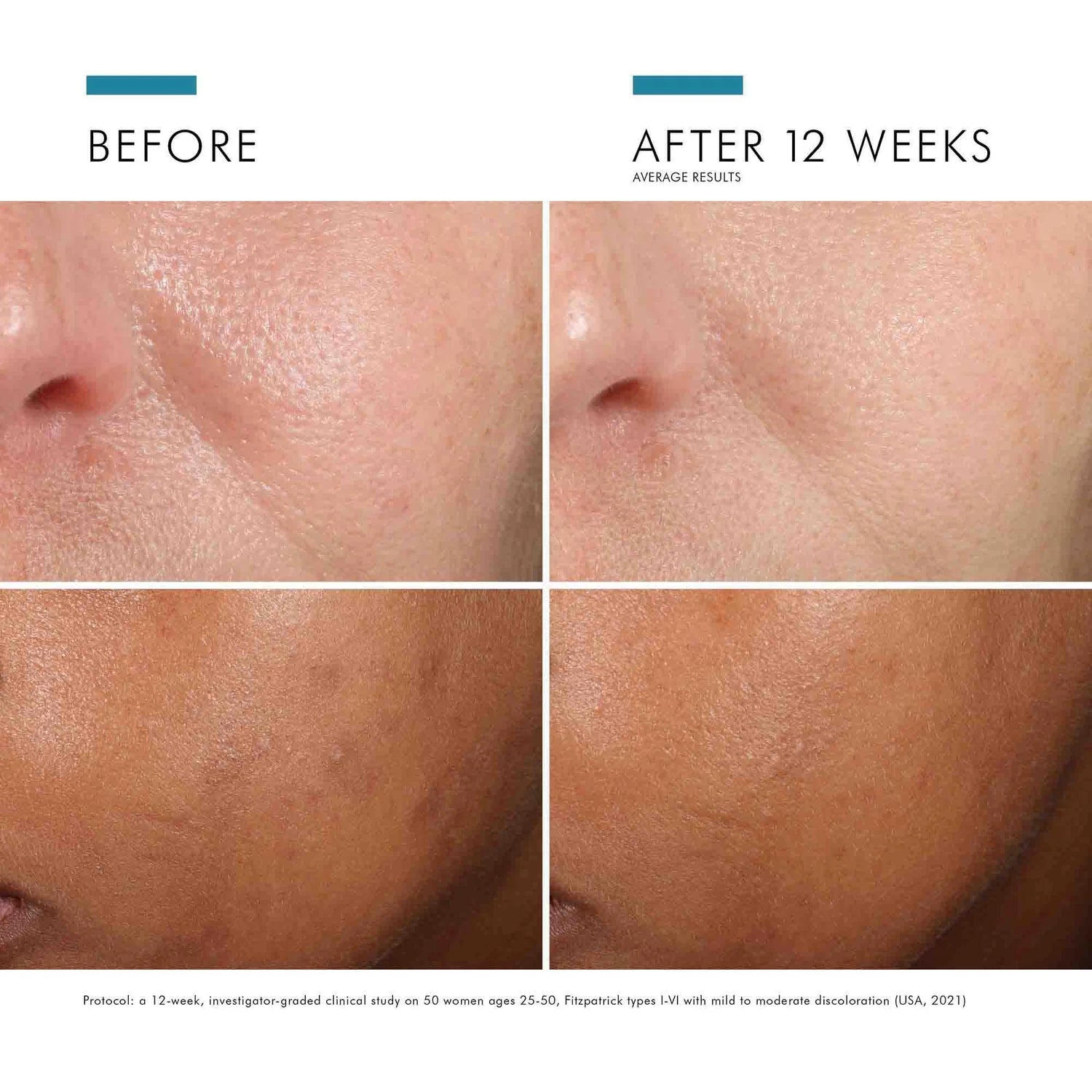 Skinceuticals, Phloretin CF antioxidant Treatment, 30 ml