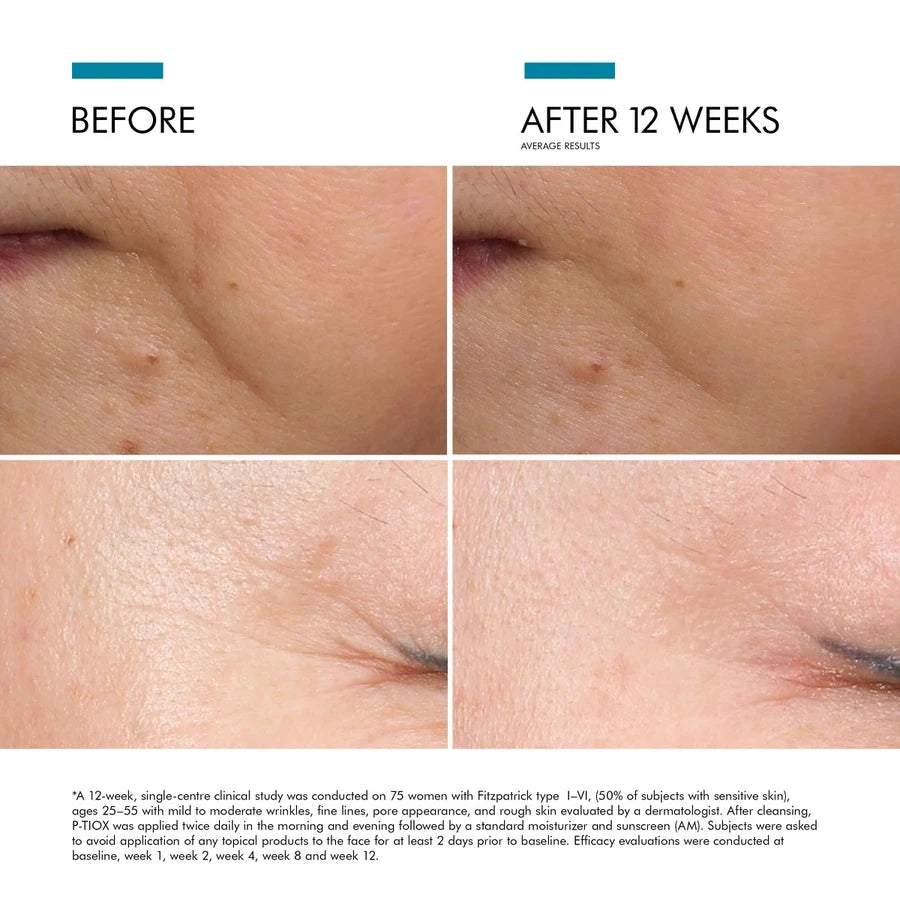 Skinceuticals, P-TIOX Serum AntiArrugas, 30 ml