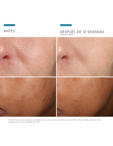 SkinCeuticals, Phloretin CF Gel, Tratamiento antioxidante con textura sérum, 30 ml